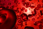 Doença Celíaca e Anemia