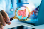 endoscopia e biópsia na doença celíaca