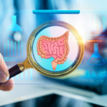 endoscopia e biópsia na doença celíaca