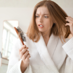 alopecia areata