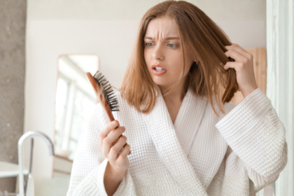 alopecia areata