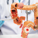 doenças autoimunes do intestino