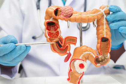 doenças autoimunes do intestino