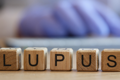 lúpus