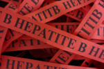 hepatite B