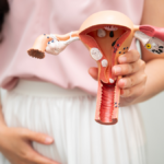 endometrite crônica e doença celíaca
