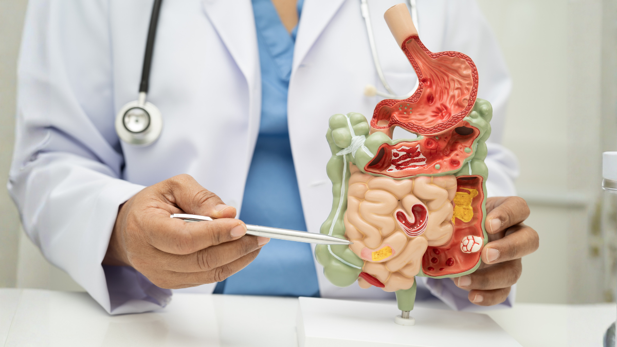 dificuldade para digerir amidos e açúcares em celíacos