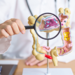 Celíacos têm maior chance de síndrome do intestino irritável? Quase 65% apresentaram alterações.