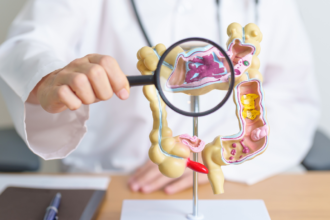 Celíacos têm maior chance de síndrome do intestino irritável? Quase 65% apresentaram alterações.