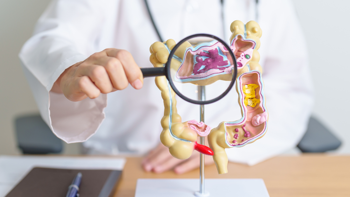 Celíacos têm maior chance de síndrome do intestino irritável? Quase 65% apresentaram alterações.