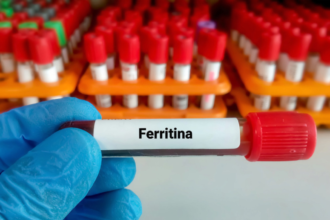 novas diretrizes de ferritina